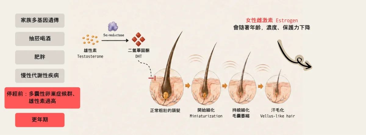 女性雄性禿毛囊變化示意圖
